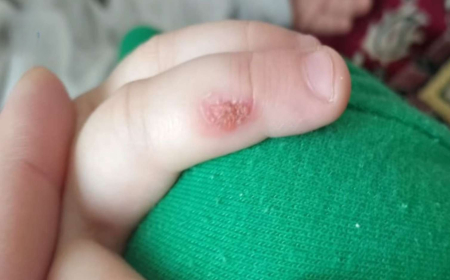 Eşqi Bağırov bağçada uşağa şiddət iddiasından danışıb