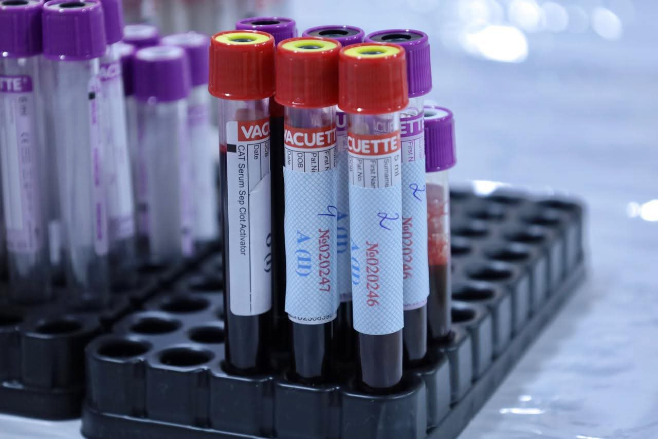 ATU-da qanvermə aksiyası keçirilib